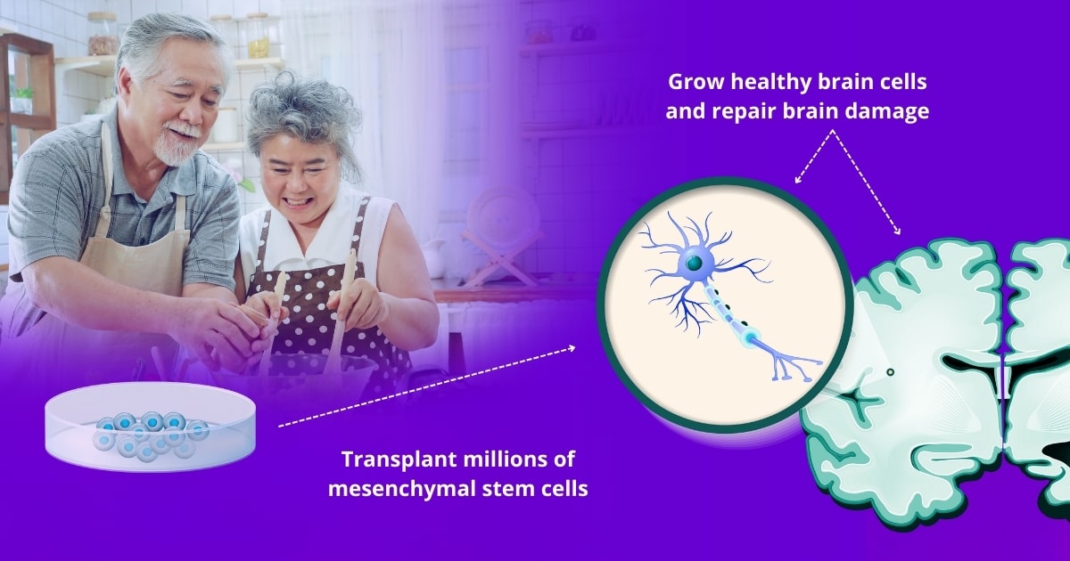 Stem cell therapy for Alzheimer's disease