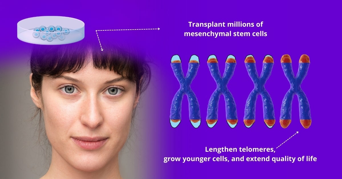 Stem cell therapy for potential anti-aging regeneration