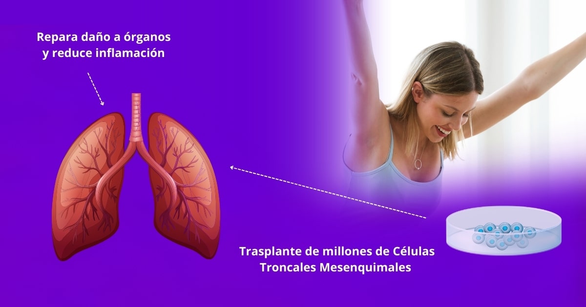 Tratamiento de Células Troncales Mesenquimales en Jalisco para long COVID