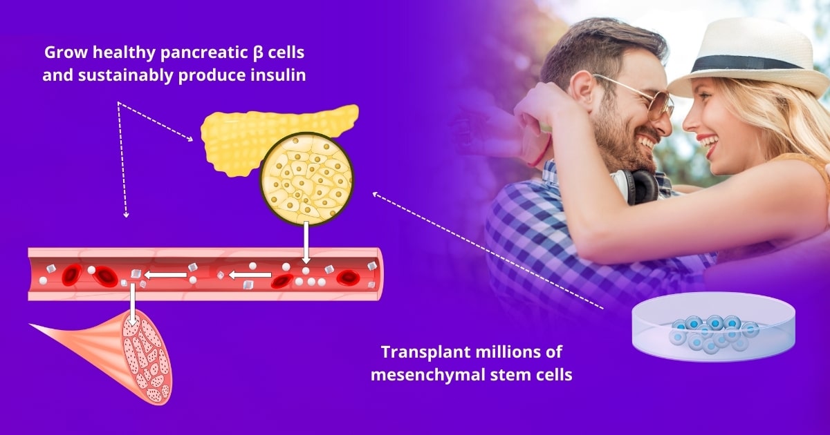 Stem cell therapy for Diabetes