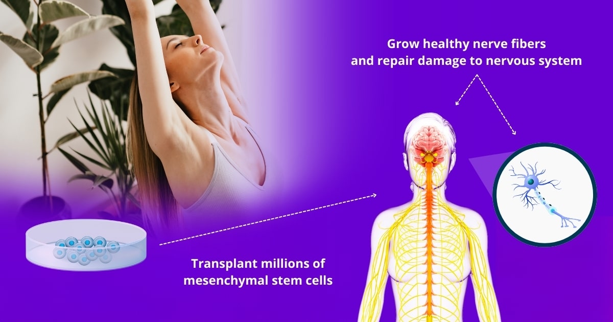 Stem cell therapy for Fibromyalgia